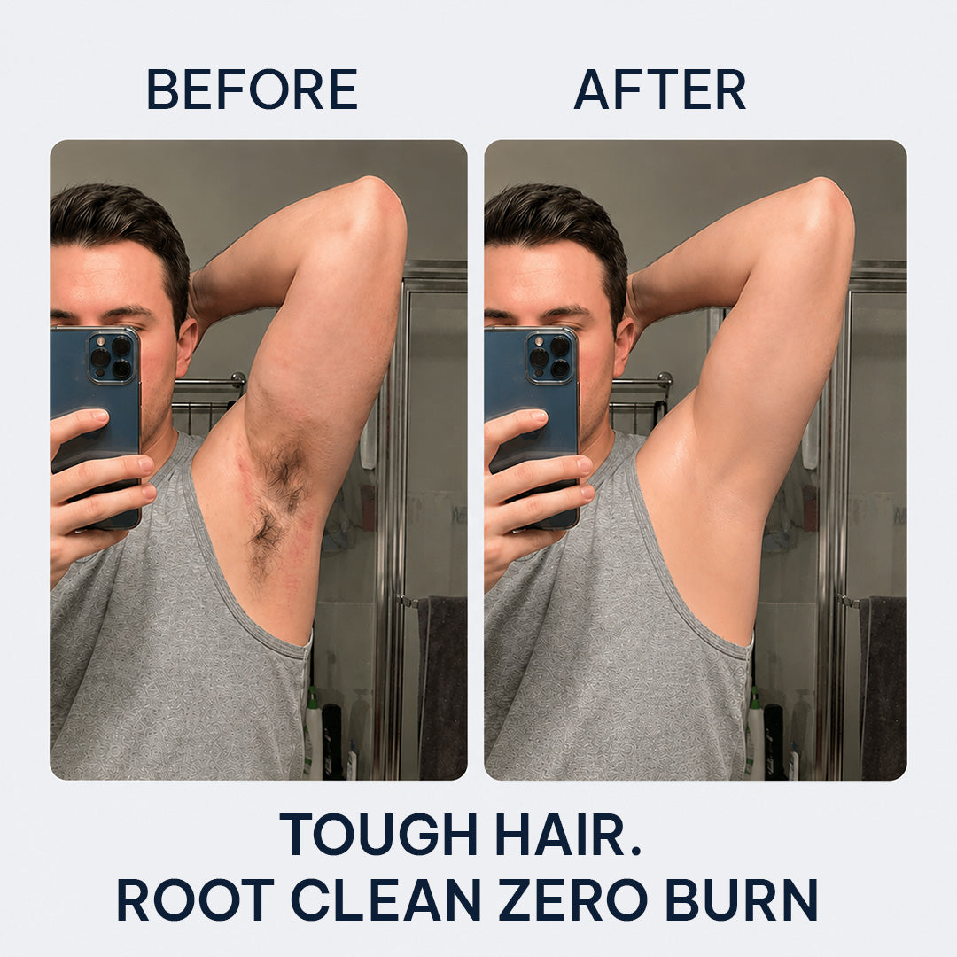 Cloud Sense™ Zero-Touch Hair Eraser